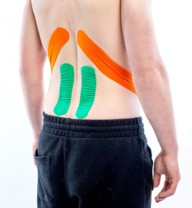 Medical Taping bij lage rugklachten